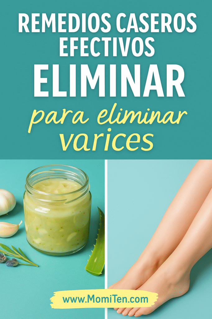 remedios caseros para las varices