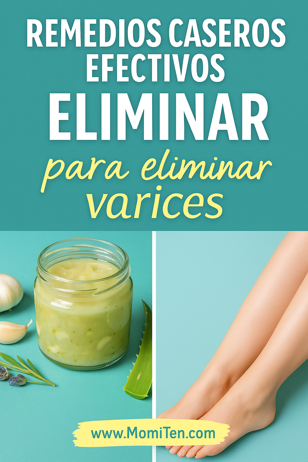 remedios caseros para las varices